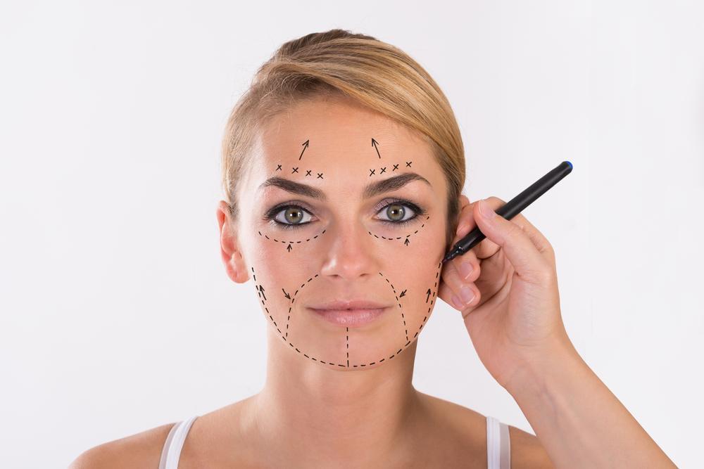preparing-for-facelift-1