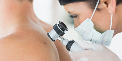 Closeup of dermatologist examining mole on back of male patient in clinic